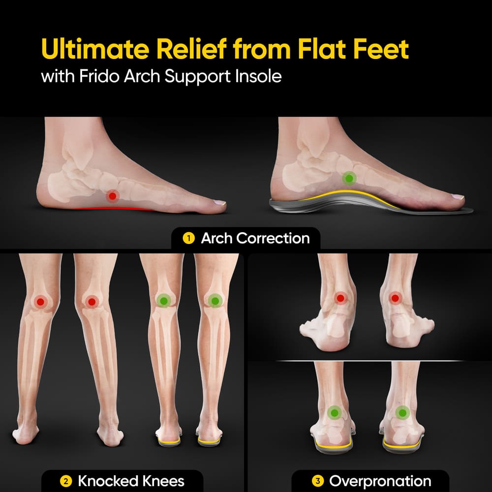 Frido Arch Support Rigid Insoles